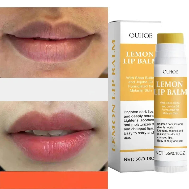 Luxury Turmeric Lip Balm – Hydrating & Moisturizing Lip Care – 5g