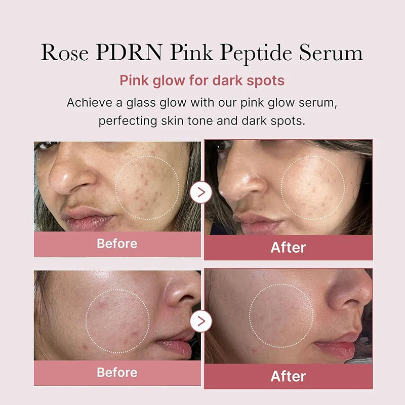 Luxury Peptide Collagen Pink Glow Face Serum – 30ml