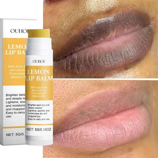Luxury Turmeric Lip Balm – Hydrating & Moisturizing Lip Care – 5g